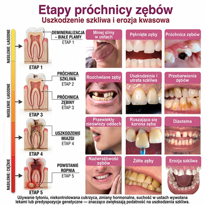 Rolimey® DenPerm – Naturalny żel wypełniający szkliwo do leczenia ubytków próchnicowych🌟