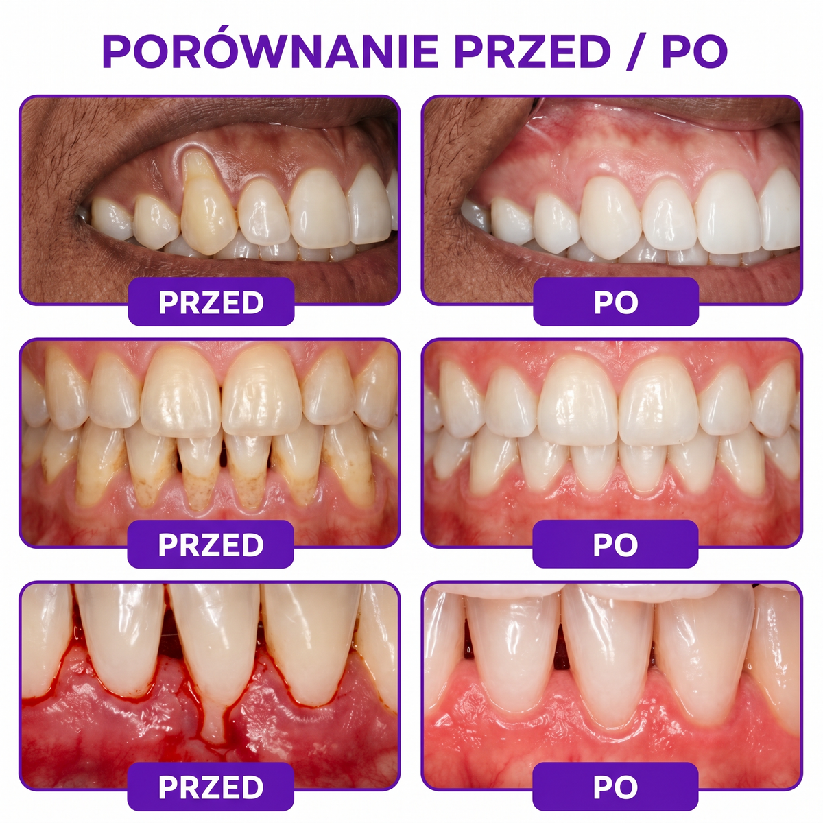 🇵🇱 🦷 Rolimey® VioCore™ 🐝 | Pasta do zębów z jadem pszczelim ✨