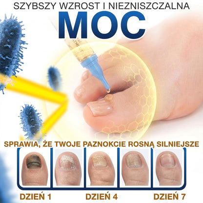 🇪🇺 Certyfikowany w UE 👩‍🔬 CareBreeze® Fungi Free – Intensywna Kuracja do Paznokci na Bazie Jadu Pszczelego 🥉