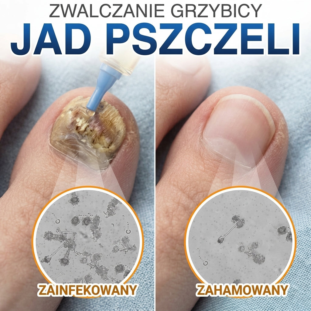 🇪🇺 Certyfikowany w UE 👩‍🔬 CareBreeze® Fungi Free – Intensywna Kuracja do Paznokci na Bazie Jadu Pszczelego 🥉
