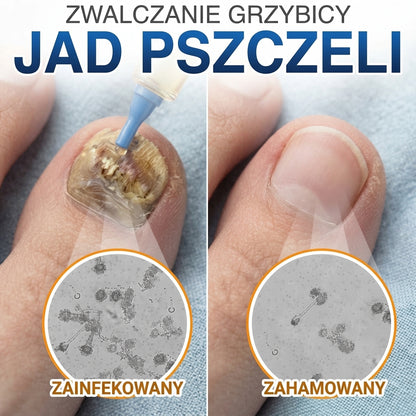 🇪🇺 Certyfikowany w UE 👩‍🔬 CareBreeze® Fungi Free – Intensywna Kuracja do Paznokci na Bazie Jadu Pszczelego 🥉
