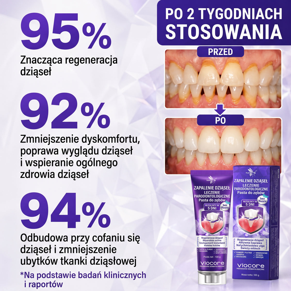 🇵🇱 🦷 Rolimey® VioCore™ 🐝 | Pasta do zębów z jadem pszczelim ✨
